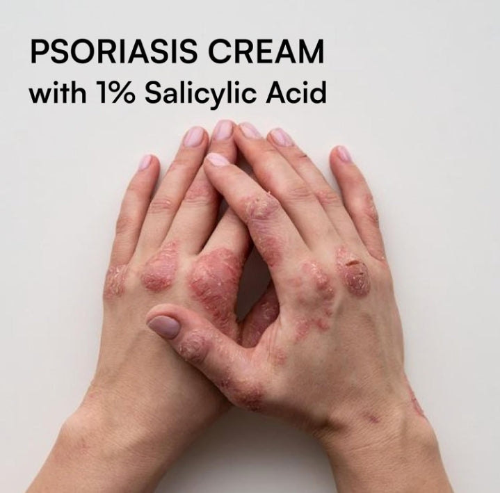 Psoramist Cream 150g